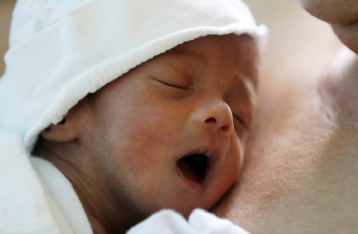 Bebés nacidos con sífilis alcanzan récord en Estados Unidos